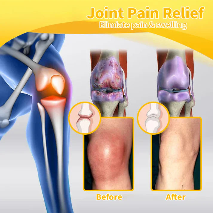 Turonu™ Bee Venom Pain-Relief Bone Healing Cream 👑 (IAD recommends)