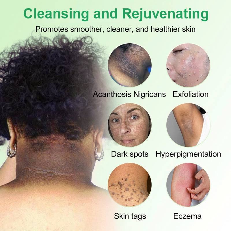 GarageLine™ Exfoliating Gel【🍇Treats Acanthosis Nigricans, Exfoliates, Fades Dark Spots🍇】
