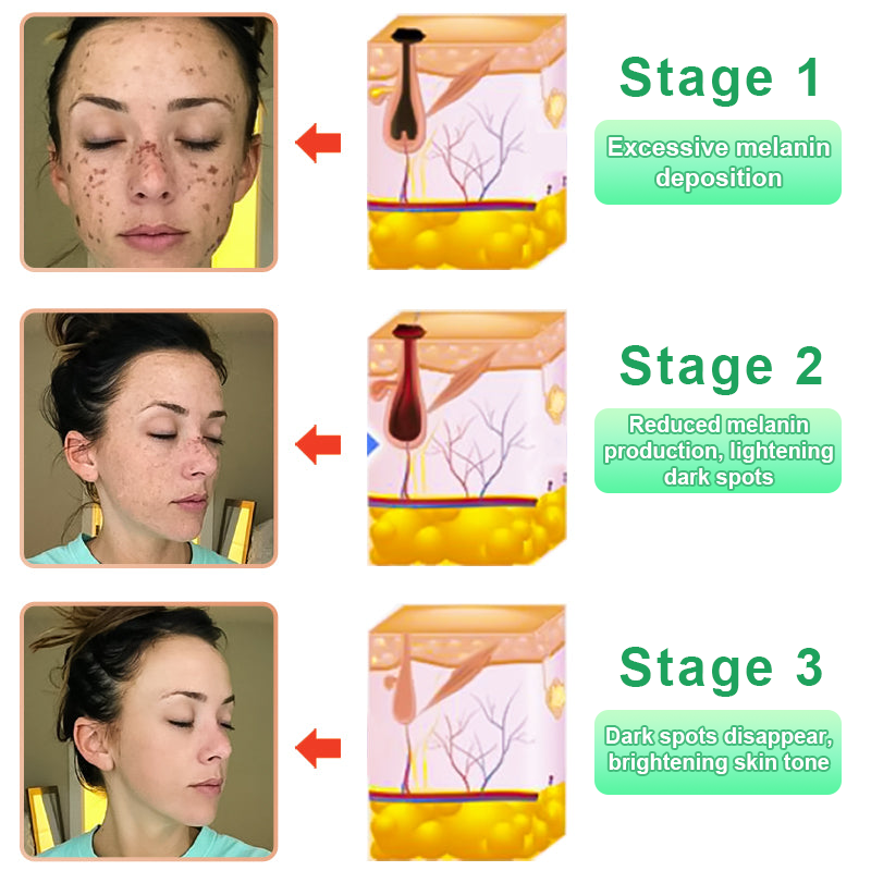 GarageLine™ Exfoliating Gel【🍇Treats Acanthosis Nigricans, Exfoliates, Fades Dark Spots🍇】
