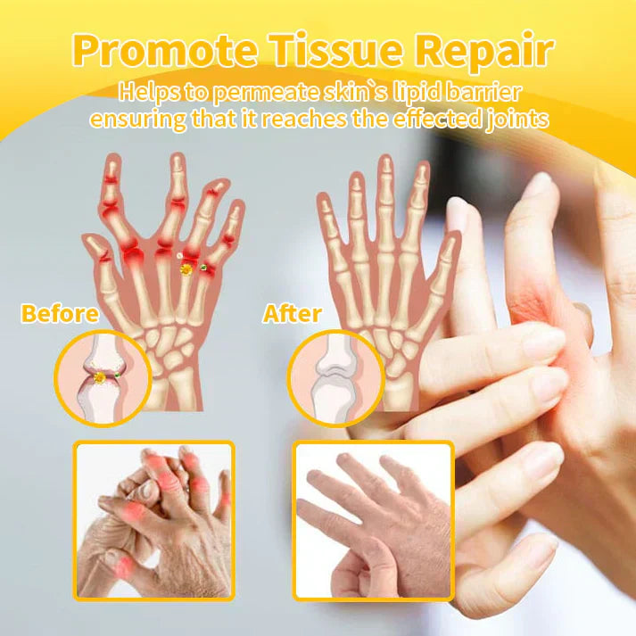 Turonu™ Bee Venom Pain-Relief Bone Healing Cream 👑 (IAD recommends)