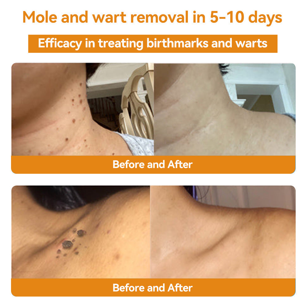 Turonu Bee Venom Skin Treatment CreamοΌπ»πΌπ΄π· π
πππππππππππ»οΌ