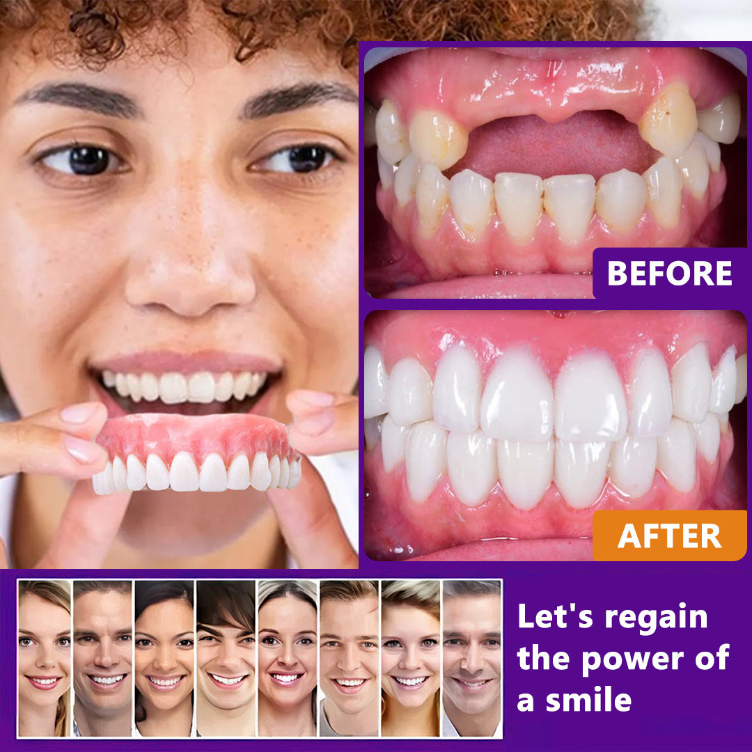 Silicone Reline Denture Set (โฐ Limited Time Discount Last 30 Minutes โฐ)๐๐ข๐ค๐๐ง๐๐โข ๐