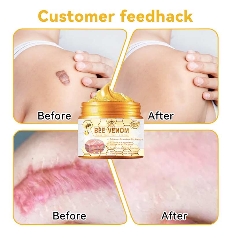 Turonu™ Luxurious Collagen Firming Cream (🌍Limited Time Discount Last 30 Minutes🌍)