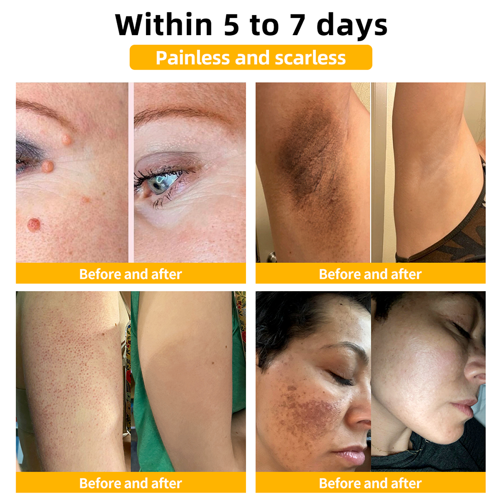 Turonu™ Luxurious Collagen Firming Cream (🌍Limited Time Discount Last 30 Minutes🌍)