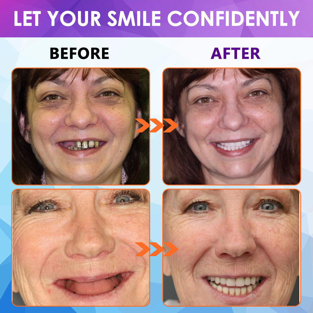 Silicone Reline Denture Set (โฐ Limited Time Discount Last 30 Minutes โฐ)๐๐ข๐ค๐๐ง๐๐โข ๐