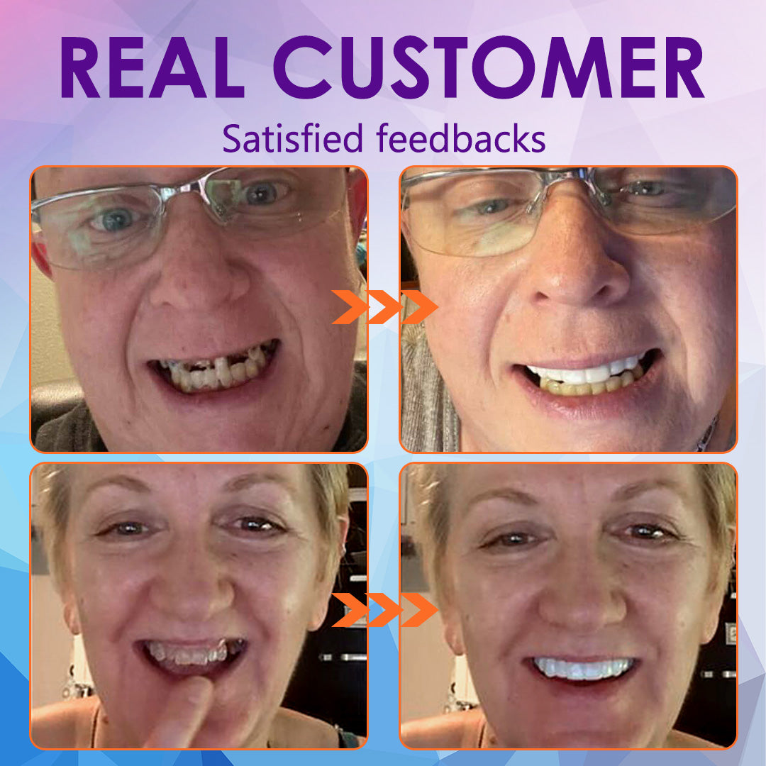 Silicone Reline Denture Set (โฐ Limited Time Discount Last 30 Minutes โฐ)๐๐ข๐ค๐๐ง๐๐โข ๐