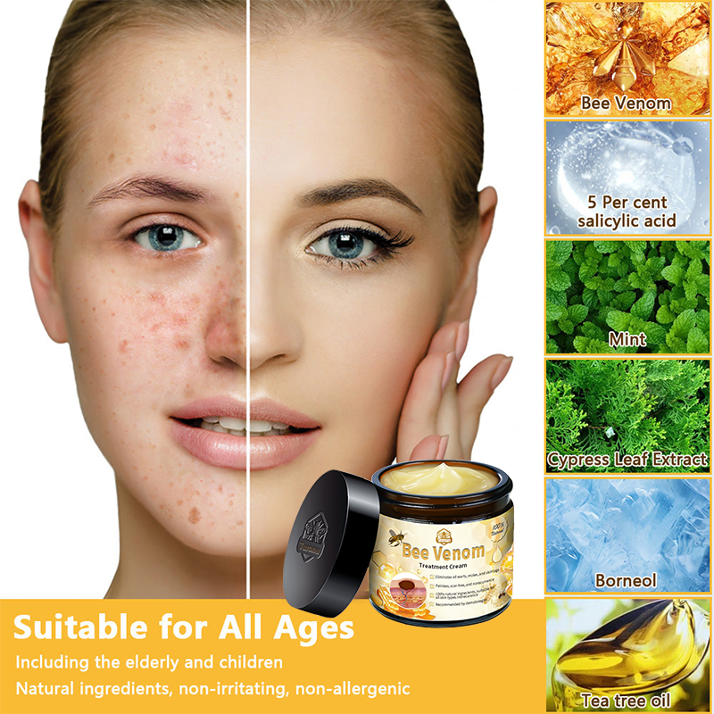 Christmas Sale 🤶🏻Turonu™ Bee Venom Treatment Cream🐝(🎄𝐼𝐴𝐷 𝑅𝑒𝑐𝑜𝑚𝑚𝑒𝑛𝑑𝑒𝑑)
