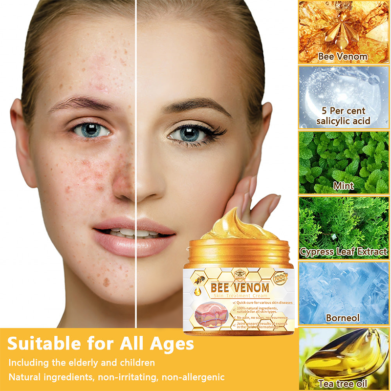 Turonu™ Luxurious Collagen Firming Cream (🌍Limited Time Discount Last 30 Minutes🌍)