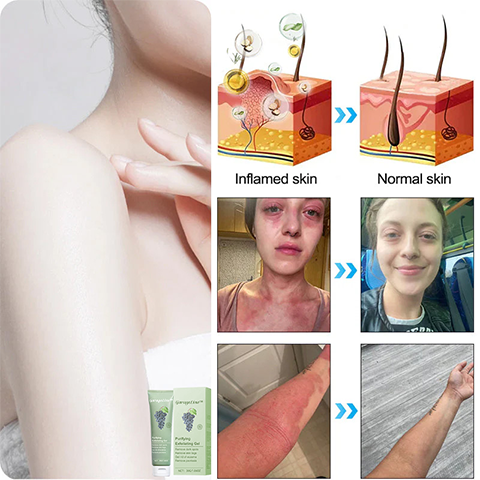 GarageLine™ Exfoliating Gel【🍇Treats Acanthosis Nigricans, Exfoliates, Fades Dark Spots🍇】