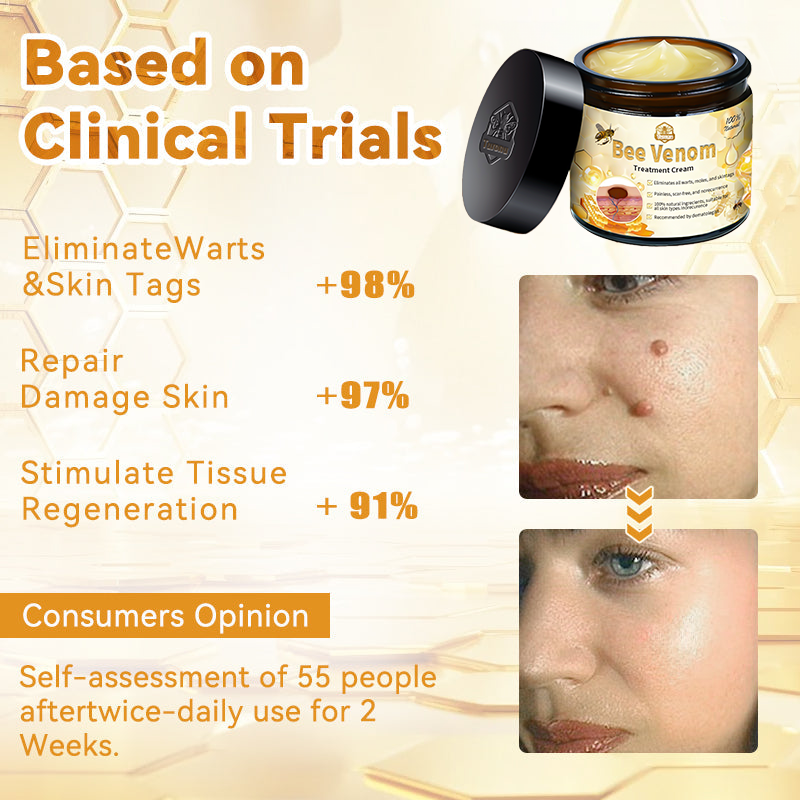 Christmas Sale 🤶🏻Turonu™ Bee Venom Treatment Cream🐝(🎄𝐼𝐴𝐷 𝑅𝑒𝑐𝑜𝑚𝑚𝑒𝑛𝑑𝑒𝑑)