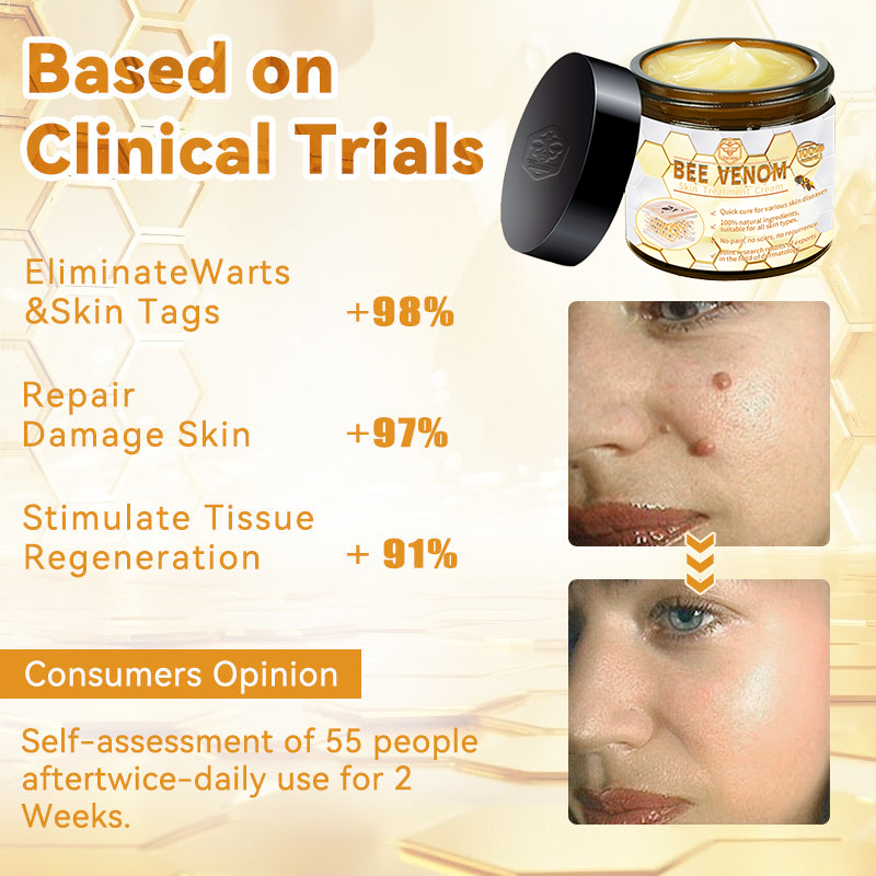 Turonu Bee Venom Skin Treatment CreamοΌπ»πΌπ΄π· π
πππππππππππ»οΌ