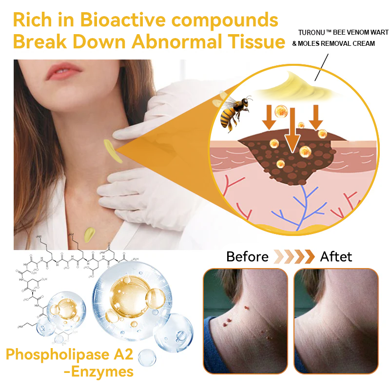 Turonu Bee Venom Skin Treatment CreamοΌπ»πΌπ΄π· π
πππππππππππ»οΌ