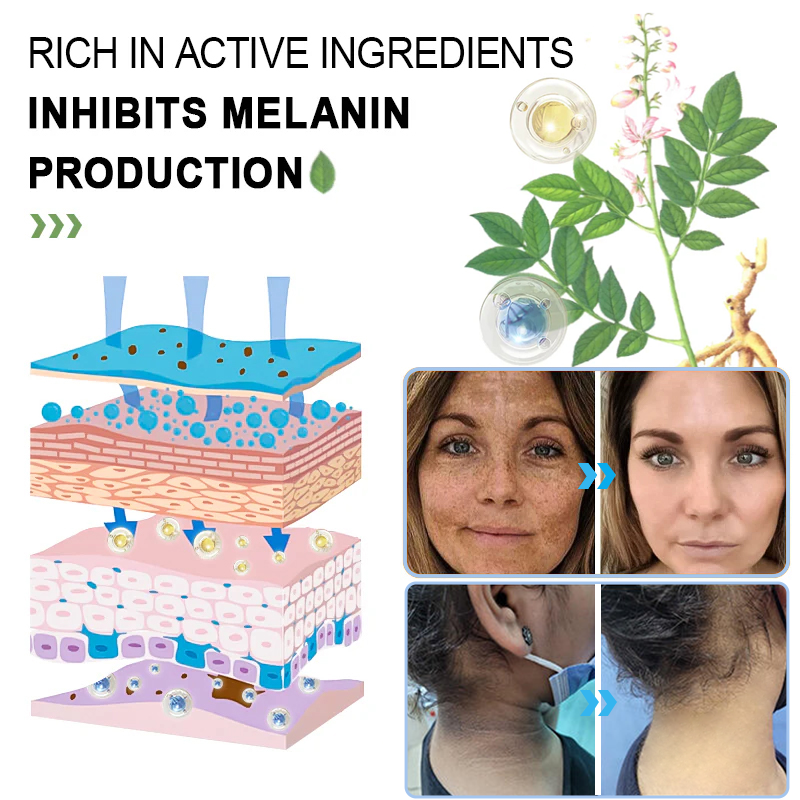 GarageLine™ Exfoliating Gel【🍇Treats Acanthosis Nigricans, Exfoliates, Fades Dark Spots🍇】