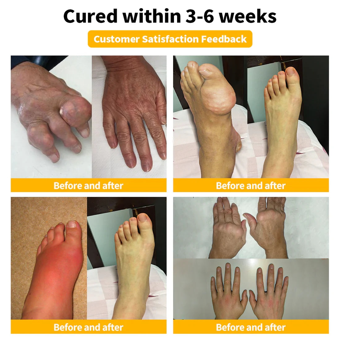 Turonu™ Bee Venom Pain-Relief Bone Healing Cream 👑 (IAD recommends)