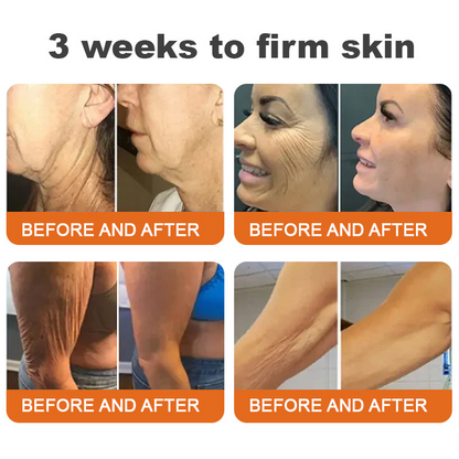 Made and Shipped from Ireland🇮🇪Turonu™ Botox Bee Venom Firming Serum Stick(🔥LAST DAY 70% OFF)